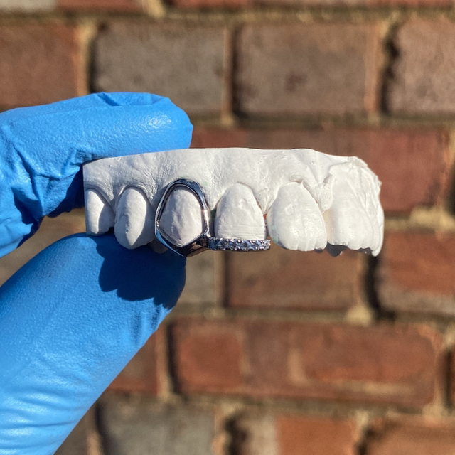 Window + Stone Set Inlay